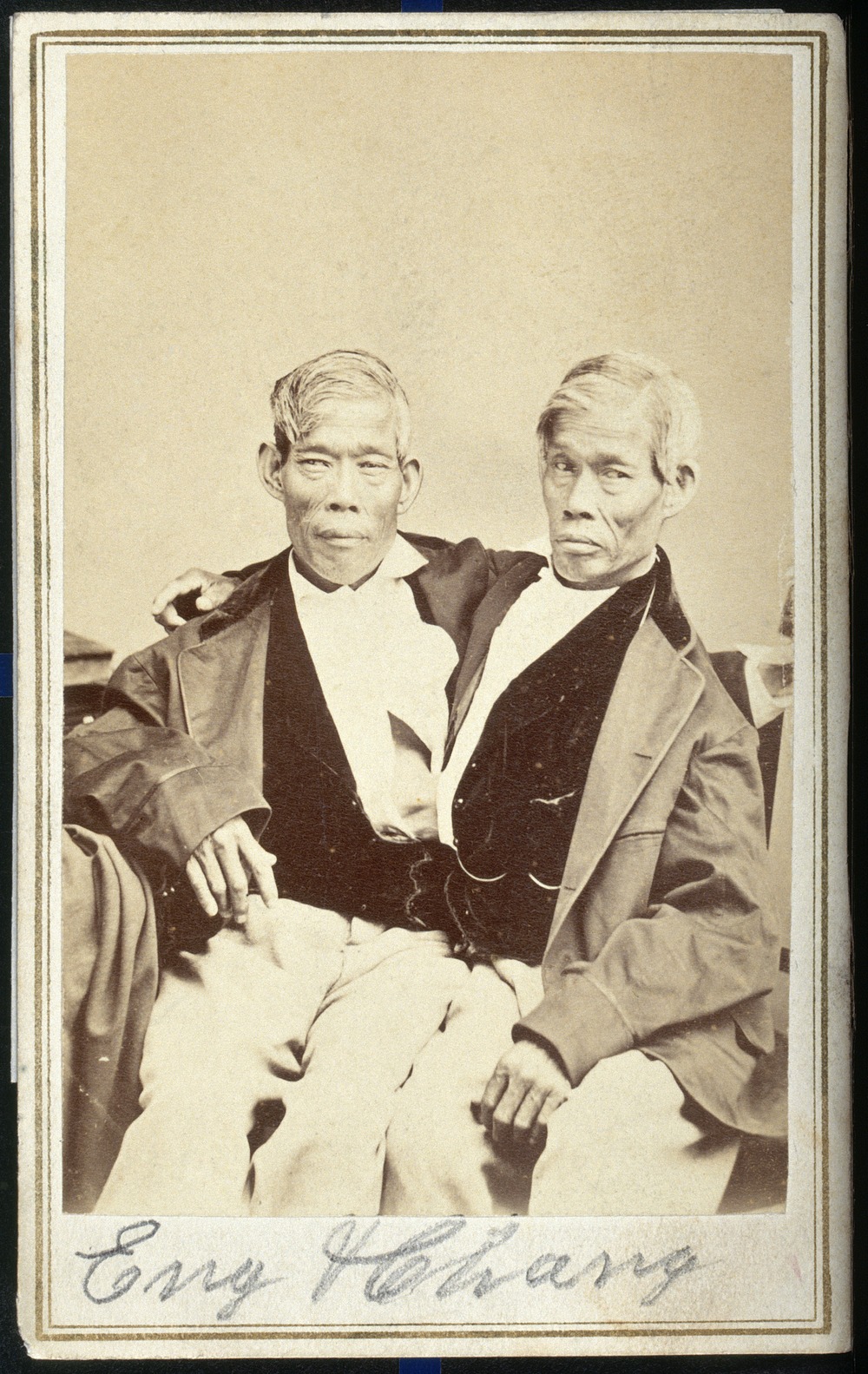 Чанг и Энг Банкеры. Фотография около 1860 года